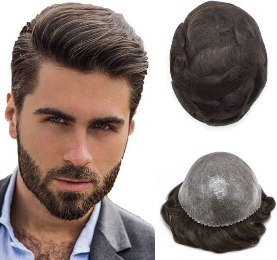 Non-Surgical Hair Replacement